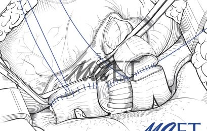 Half Day Webinar – Adobe Illustrator – Tips and tricks for drawing anatomy